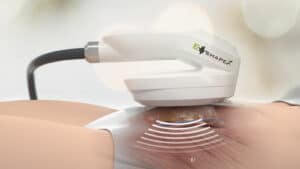 EMSHAPE basiert auf elektromagnetischer Stimulation.