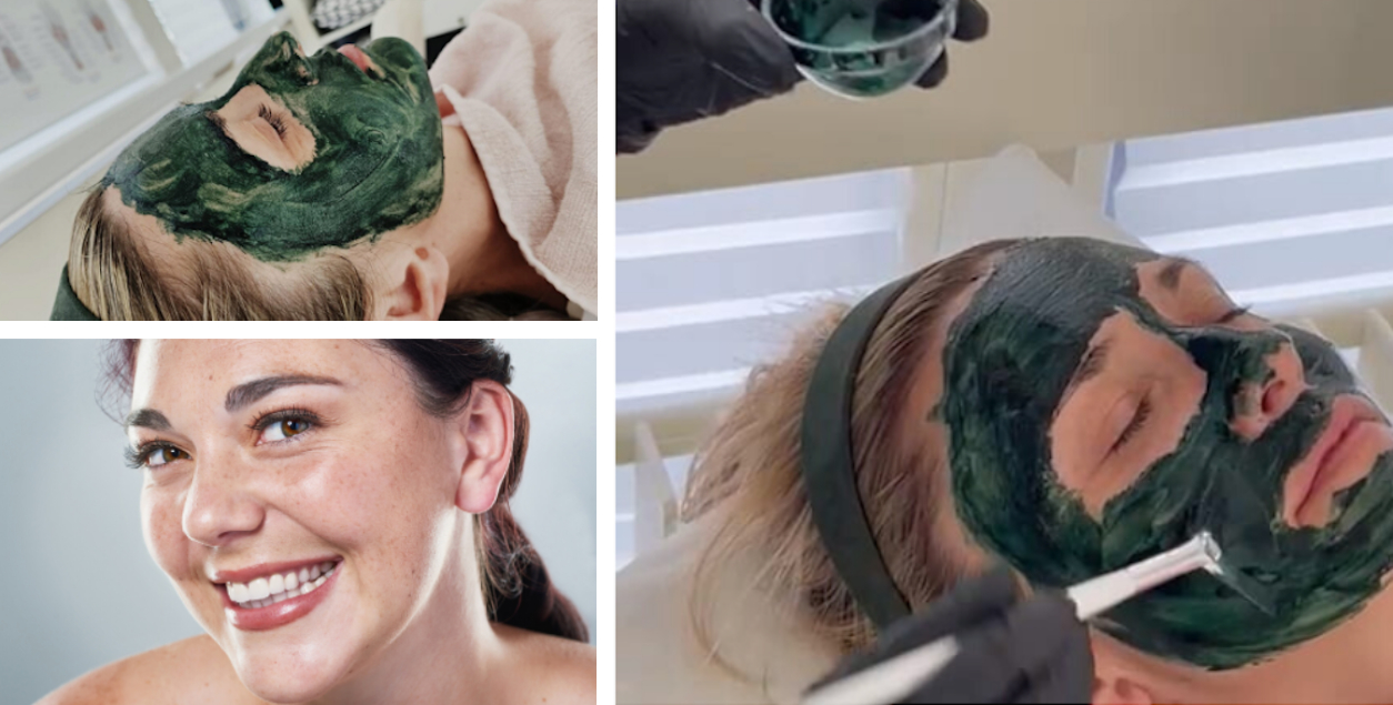 biopeel-x-st-gallen