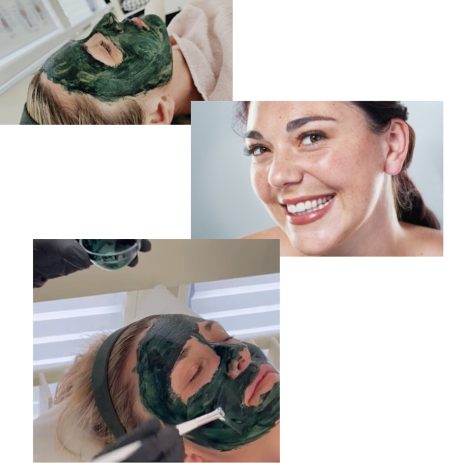 biopeel-x-st-gallen-kaiser